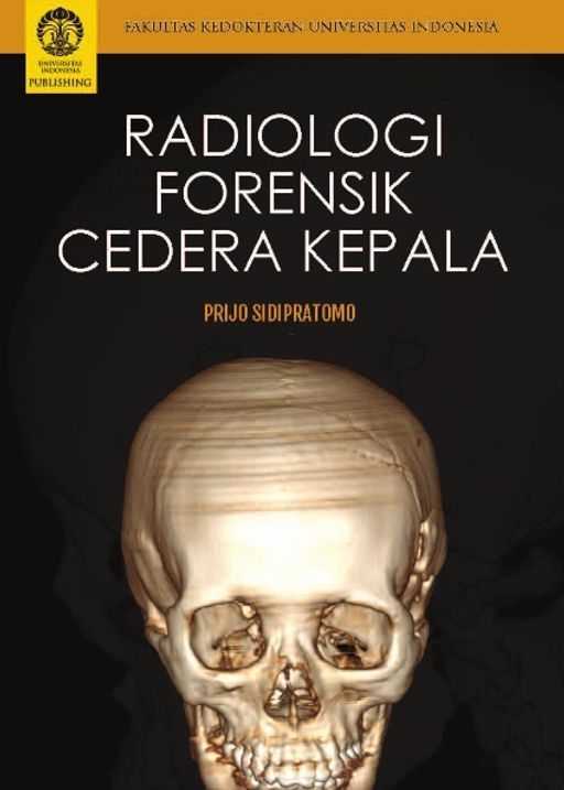 Radiologi Forensik Cedera Kepala